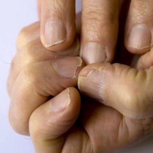 5 problemer med neglene, som kan med alvorlige sygdomme. - Podaj.to
