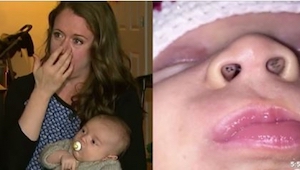 Hun gav sit barn bryst, da hun opdagede nogle mærkelige sorte pletter på hans næ