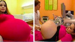 Denne 23-årige kvinde ventede tvillinger, men efter at have set sin ultralydssca