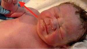 Denne baby skulle ikke have været født… Da de åbnede hans knyttede hånd, forstod