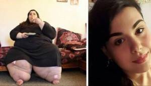 Denne pige vejede 298 kg. Se hvordan hun ser ud efter at have tabt over 150 kilo