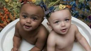 Verdens første tvillinger med forskellig hudfarver er allerede voksne. Hvordan s